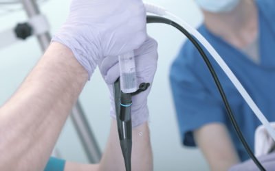 Gastroenterologia – Endoscopia Digestiva